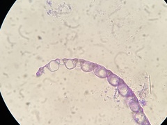 Sphagnum tenellum