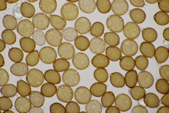 Uromyces trifolii-repentis fallens