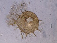 Centropyxis aculeata