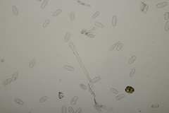 Podosphaera euphorbiae