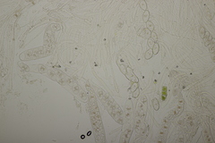 Octosporopsis nicolai