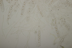 Octosporopsis nicolai