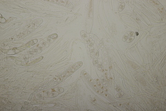 Octosporopsis nicolai