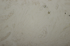 Octosporopsis nicolai