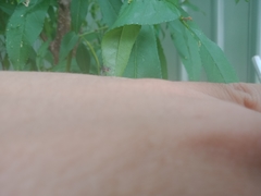 Aedes notoscriptus