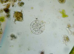 Actinosphaerium