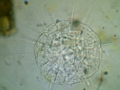 Actinosphaerium