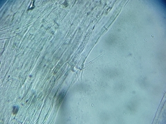 Coprinellus saccharinus