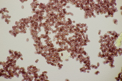 Lepiota subincarnata