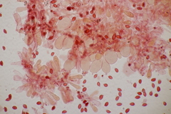 Lepiota subincarnata