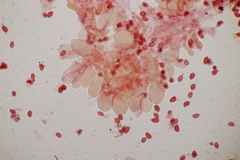 Lepiota subincarnata