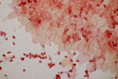 Lepiota subincarnata