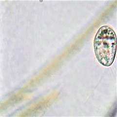 Uronemella filificum