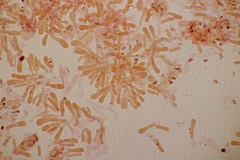 Melanophyllum haematospermum