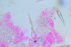 Peniophorella