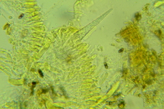 Peniophorella