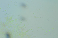 Trechispora regularis