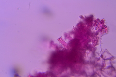 Exobasidium maculosum