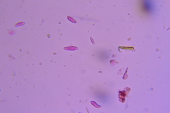 Exobasidium maculosum