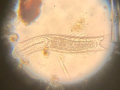 Chaetonotus