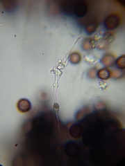 Didymium squamulosum