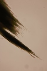 Aphanizomenon flosaquae