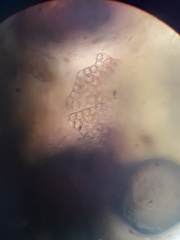 Frullania incumbens