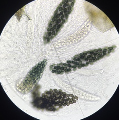 Podospora setosa