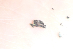 Phaeophyscia hirtella