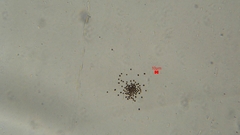 Radiocystis
