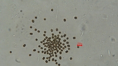 Radiocystis