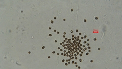 Radiocystis