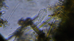 Chaetonotida
