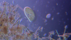 Paramecium bursaria