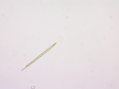 Planktothrix