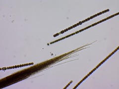 Aphanizomenon flosaquae