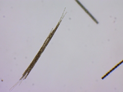 Aphanizomenon flosaquae