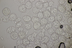 Hypomyces papulasporae