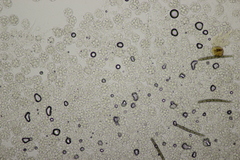 Hypomyces papulasporae