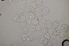 Hypomyces papulasporae