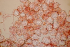 Hypomyces papulasporae