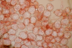 Hypomyces papulasporae