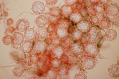 Hypomyces papulasporae