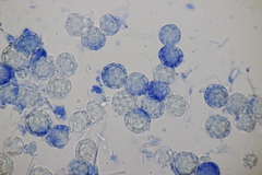 Hypomyces papulasporae