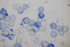 Hypomyces papulasporae
