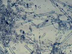 Hypomyces mycophilus