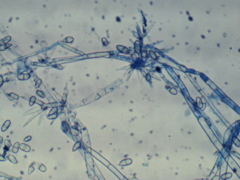 Hypomyces mycophilus