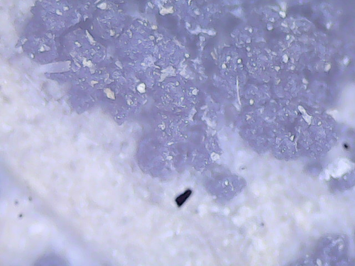 Giberela (Fusarium graminearum)