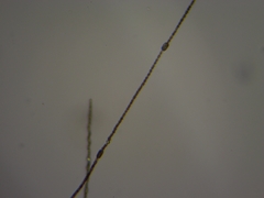 Dolichospermum planctonicum