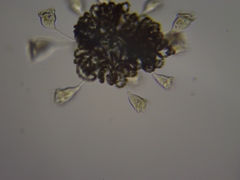 Dolichospermum lemmermannii